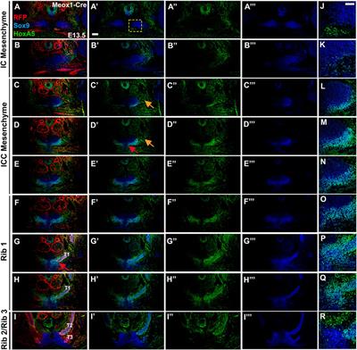 Hoxa5 Activity Across the Lateral Somitic Frontier Regulates Development of the Mouse Sternum